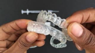 How to use Tooth Whitening Trays [upl. by Asquith785]