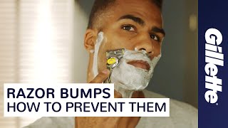 Want to Prevent Razor Bumps Learn How to Minimize Ingrown Hairs  Gillette [upl. by Sirad41]