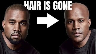 Kanye West is Going Bald [upl. by Ahsenom]