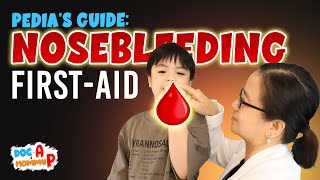 FIRST AID sa PAGDUGO ng ILONG ng Bata o NOSE BLEEDING  Doc A Pediatrician [upl. by Eentroc]