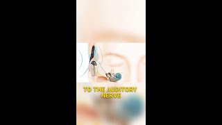 How Cochlear Implants Restore Hearing [upl. by Dianemarie]