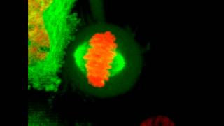 Mitosis in 2D  HeLa cell undergoes mitosis [upl. by Muns]