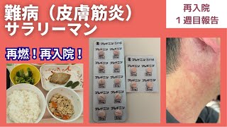 【再燃・再入院】【皮膚筋炎】再スタート始まりました。【Incurable Disease】【Dermatomyositis】【Readmission】The restart has begun [upl. by Zetrom]