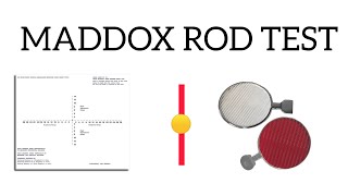 Maddox rod test  Principles  Thorington test  Made Easy [upl. by Tenahs]