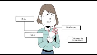 Artritis psoriásica síntomas tratamiento y consejos [upl. by Lezti752]