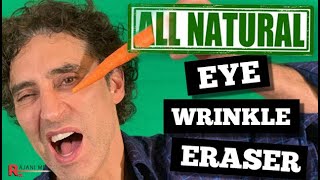 Eye Wrinkle Treatment  All Natural Under Eye Filler Before After [upl. by Elana]