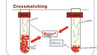 Cross match test Complete procedure Step By Step major and minor [upl. by Ahsaele]