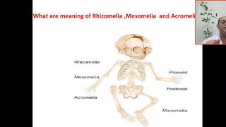 What are the meaning or the difference between Rhizomelia Mesomelia and Acromelia Shortage of limb [upl. by Kappenne]