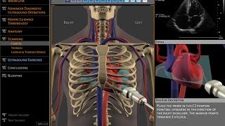 Basics of ultrasound machine [upl. by Llenahs]