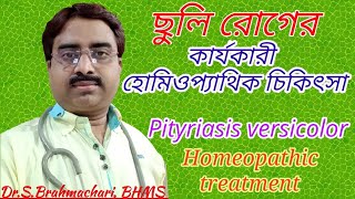 Pityriasis versicolor homeopathic treatment in bangla [upl. by Hteboj917]