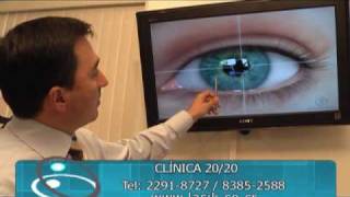 Cirugia con laser para dejar de usar anteojos [upl. by Sells]