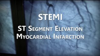 NHRMC Heart Center  STEMI Training Video [upl. by Ody]