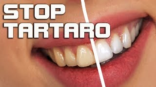 Togliere il tartaro dai denti rimedi naturali per la pulizia dei denti [upl. by Nawk]