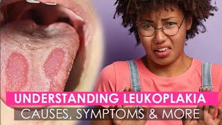 Oral Leukoplakia amp How to Treat It with Guru Nanda [upl. by Quincey270]