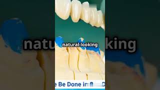 Can A Dental Bridge Be Done In One Day  Same Day Dental Bridge  Daily Dentists [upl. by Yehus]