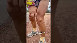 TEARING knee cartilage by running a week of marathons [upl. by Eirod]