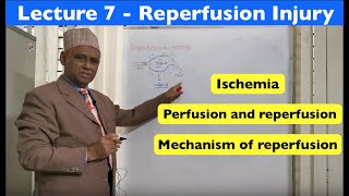 General Pathology  Lecture 7  Reperfusion Injury [upl. by Hgielah]