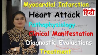 Myocardial Infarction or Heart Attack  Part2  Pathophysiology  Sign amp Symptoms  Diagnosis [upl. by Queston]