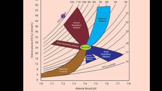 Part 2 Acidosis and Alkalosis Metabolic or Respiratorymp4 [upl. by Aihsenal]