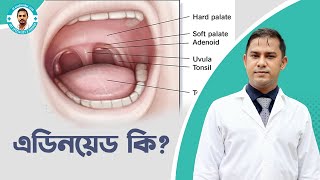 এডিনয়েড হলে কি কি সমস্যা হয় What are Adenoids Tonsils and Adenoids Operation [upl. by Icul]