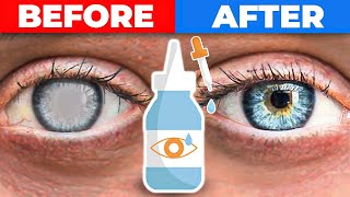 The 1 Remedy for Cataracts [upl. by Si924]