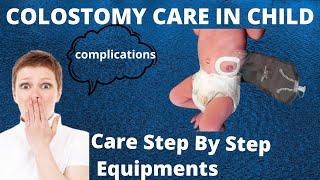 Colostomy Care in Child  Colostomy Definition Types Indications  Colostomy Care Step By Step [upl. by Anawd]