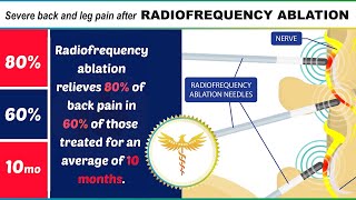 Neurosurgeon explains severe back or leg pain after RADIOFREQUENCY ABLATION [upl. by Parhe414]