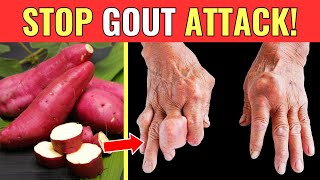 Uric acid Foods to Avoid amp Eat  Stop High Uric Acid  Gout  Uric acid  Best amp Worst Foods [upl. by Musette30]