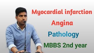 Myocardial infarction heart attack amp Angina diagnosis Pathology MBBS 2nd year concept Robbins [upl. by Burrton]