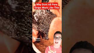 Greatest PORE STRIP REMOVAL EVER shorts [upl. by Elinor924]