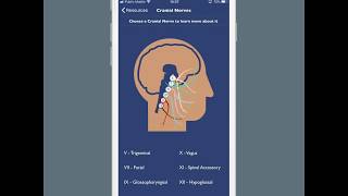 Dysphagia Therapy App Demonstration [upl. by Reppep182]