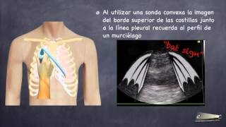 ECO PULMONAR [upl. by Phipps]