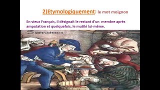 traumatologie AMPUTATIONS DE MEMBRE INFERIEUR [upl. by Melac752]