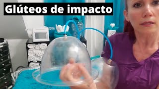 Copas REDONDAS para VACUUMTERAPIA logra unos glúteos XXL con la máquina 2021Parte 2 [upl. by Annez]