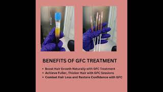 HAIR REGROWTH WITH GFC amp MESOTHERAPY [upl. by Bower]