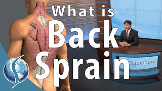 What is a Back Sprain [upl. by Macpherson]