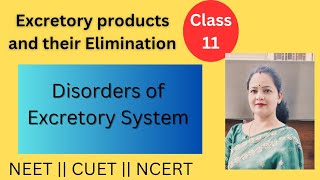 Disorders of Excretory System  Excretory products and their Elimination  Biology class 11 [upl. by Cired95]