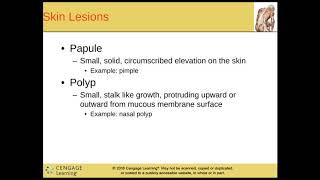 Medical Terminology Chapter 5  Integumentary System  Part 1 [upl. by Hepza]