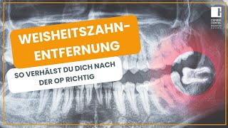 Weisheitszahnentfernung – So verhältst du dich nach der OP richtig  Carree Dental Köln [upl. by Om782]