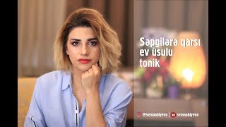 Səpgi və sızanaqlara qarşı ev üsulu tonik [upl. by Idissak]