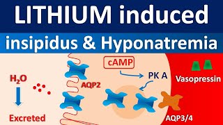 Lithium induced diabetes insipidus and hyponatremia [upl. by Powel]