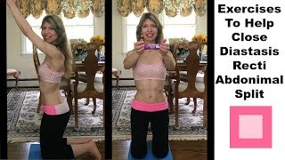 Exercises To Help CloseRepair a Diastasis Recti 2 Abdominal Split Separation [upl. by Tarryn623]