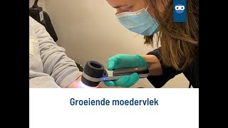 groeiende moedervlek [upl. by Halpern]