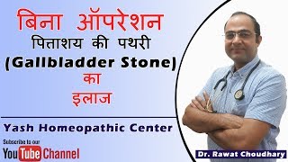 पित्ताशय की पथरी Gallbladder Stone का बिना ऑपरेशन के इलाज  Yash Homeopathic Center [upl. by Eno645]