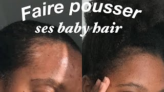 6 ASTUCES POUR FAIRE POUSSER SES BABY HAIR RAPIDEMENT tempes dégarnies alopécie [upl. by Oicnerual]