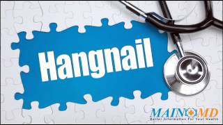 Hangnail ¦ Treatment and Symptoms [upl. by Anaugal]