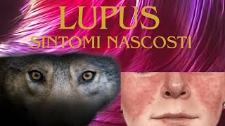 Lupus Eritematoso Segnali Trattamenti e Consigli per la Vita Quotidiana [upl. by Charleen936]