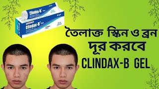 Clindacin Lotion  মুখের ব্রন ও চোখের নিচের কালো দাগ দূর করার লোশন  Incepta Pharmaceuticals Ltd [upl. by Esej]