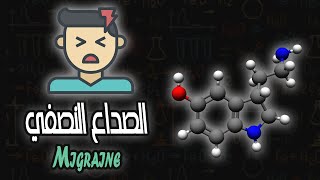 الصداع النصفي  Migraine [upl. by Assyl]