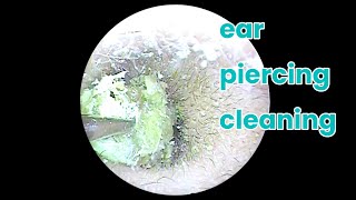 asmr ear cleaning  wax in your ear  Ear health  ear piercing cleaning how to unclog your ear [upl. by Varion]